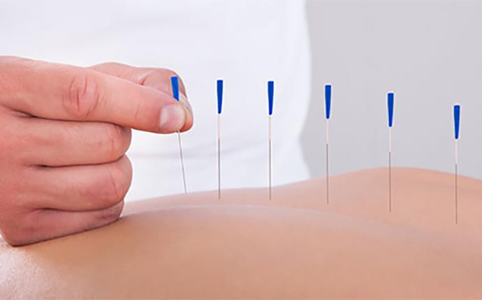 آیا از خدماتی که در بهترین مرکز طب سوزنی لاغری تهران انجام می شود اطلاعی دارید؟